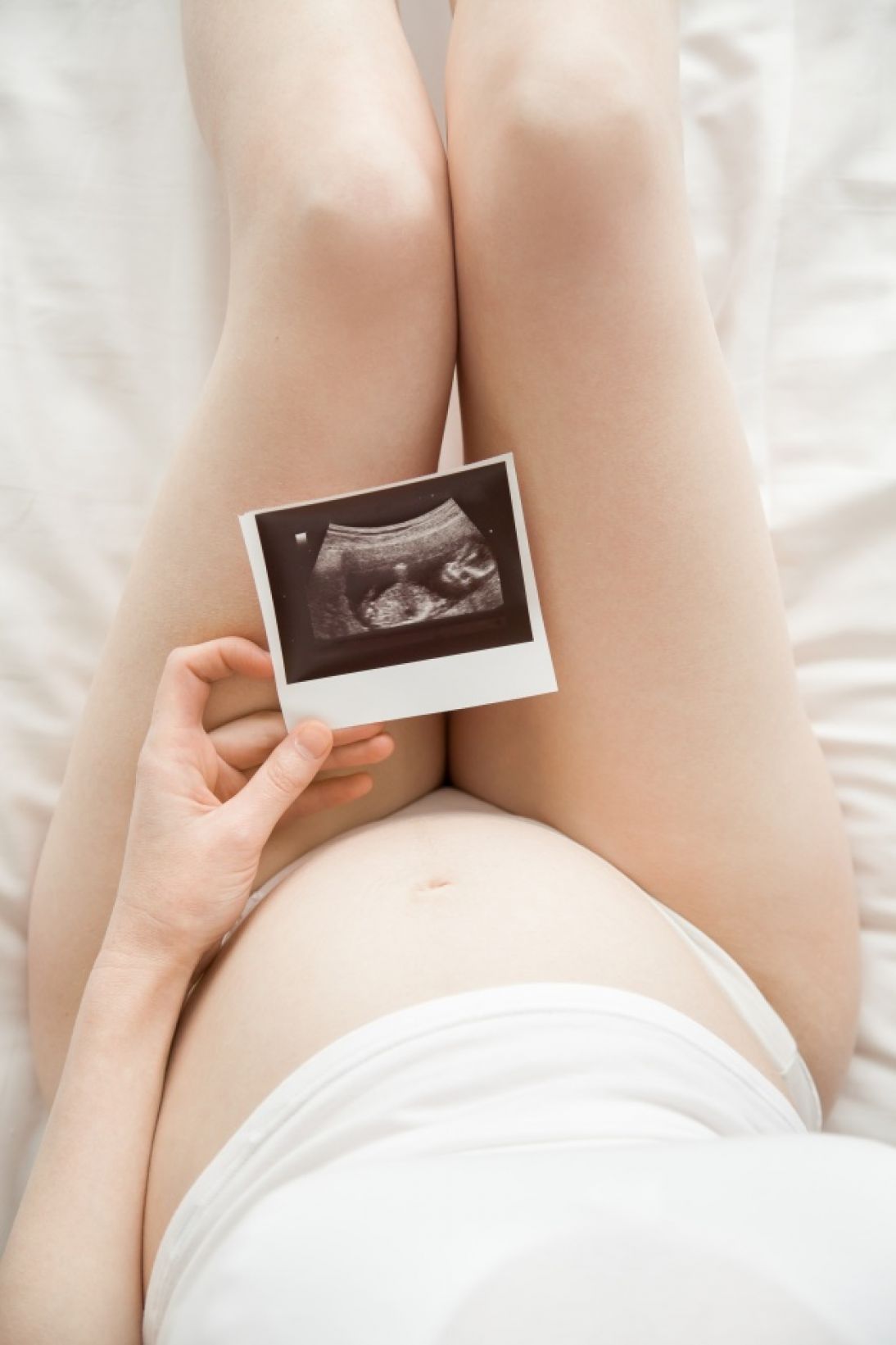 Interruption Médicale de Grossesse : IMG et psychisme